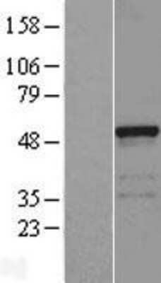 Western Blot: FAM113B Overexpression Lysate (Adult Normal) [NBL1-10448] Left-Empty vector transfected control cell lysate (HEK293 cell lysate); Right -Over-expression Lysate for FAM113B.