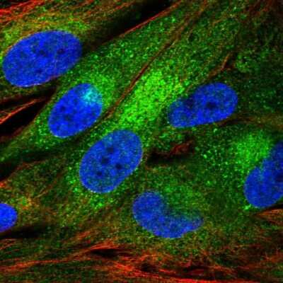 Immunocytochemistry/Immunofluorescence: FAM114A1 Antibody [NBP2-55910] - Staining of human cell line BJ shows localization to cytosol & the Golgi apparatus.