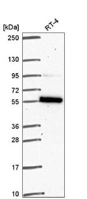 Western Blot: FAM114A1 Antibody [NBP2-55910] - Western blot analysis in human cell line RT-4.