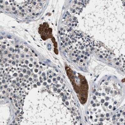Immunohistochemistry-Paraffin: FAM116B Antibody [NBP1-81110] - Staining of human testis shows distinct cytoplasmic positivity in Leydig cells.