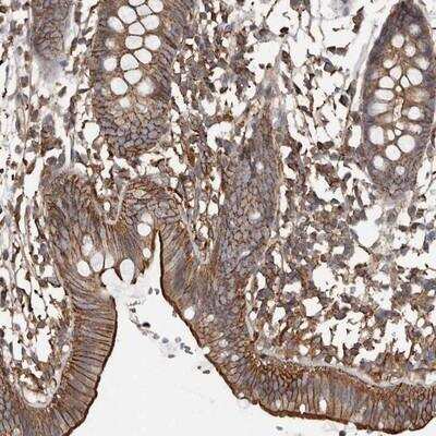 Immunohistochemistry-Paraffin FAM116B Antibody - BSA Free