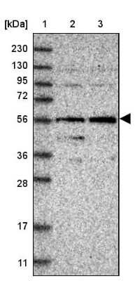 Western Blot: FAM116B Antibody [NBP1-81110] - Lane 1: Marker  [kDa] 230, 130, 95, 72, 56, 36, 28, 17, 11.  Lane 2: Human cell line RT-4.  Lane 3: Human cell line U-251MG sp