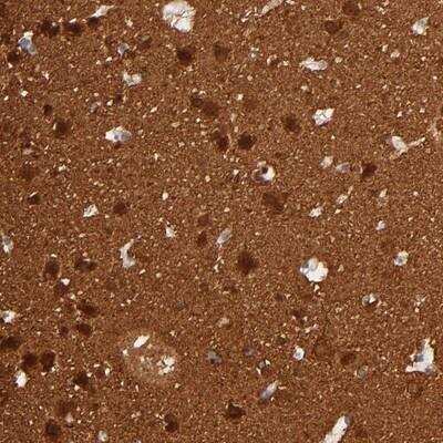 Immunohistochemistry-Paraffin: FAM117B Antibody [NBP1-90861] - Staining of human cerebral cortex shows strong nuclear and cytoplasmic positivity in neuronal cells.