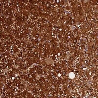 Immunohistochemistry-Paraffin: FAM118B Antibody [NBP1-93958] - Staining of human liver shows strong cytoplasmic positivity in hepatocytes.