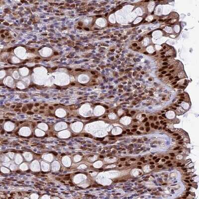 Immunohistochemistry-Paraffin: FAM118B Antibody [NBP1-93959] - Staining of human rectum shows strong nuclear positivity in glandular cells.