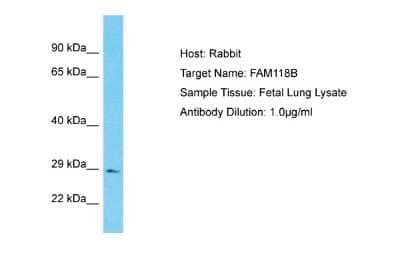 Western Blot: FAM118B Antibody [NBP2-84884] - Host: Rabbit. Target Name: FAM118B. Sample Type: Fetal Lung lysates. Antibody Dilution: 1.0ug/ml
