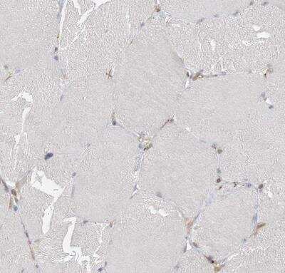 Immunohistochemistry-Paraffin: FAM119A Antibody [NBP1-83282] - Staining of human skeletal muscle shows no positivity in myocytes.