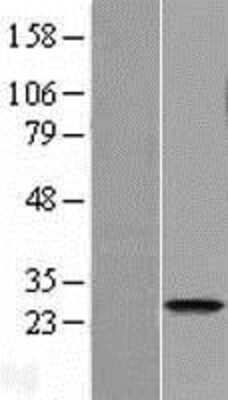 Western Blot: FAM119A Overexpression Lysate (Adult Normal) [NBP2-11375] Left-Empty vector transfected control cell lysate (HEK293 cell lysate); Right -Over-expression Lysate for FAM119A.