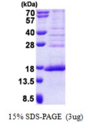 SDS-Page: FAM119A Protein [NBP2-23232]