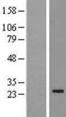 Western Blot: FAM119B Overexpression Lysate (Adult Normal) [NBL1-10455] Left-Empty vector transfected control cell lysate (HEK293 cell lysate); Right -Over-expression Lysate for FAM119B.