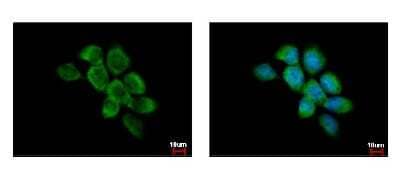 Immunocytochemistry/Immunofluorescence: FAM120A Antibody [NBP2-16412] - A431 cells were fixed in 4% paraformaldehyde at RT for 15 min. Green: FAM120A protein stained by FAM120A antibody diluted at 1:500. Blue: Hoechst 33343 staining.