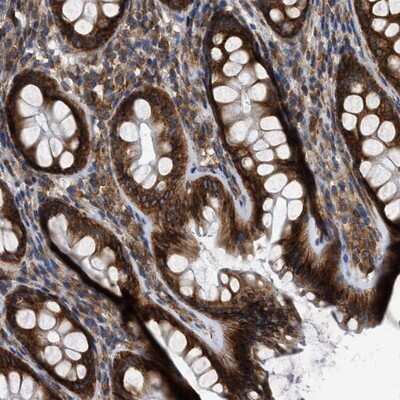 Immunohistochemistry-Paraffin FAM120A Antibody