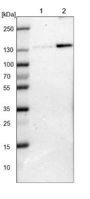 Western Blot: FAM120A Antibody [NBP1-86715] - Lane 1: NIH-3T3 cell lysate (Mouse embryonic fibroblast cells). Lane 2: NBT-II cell lysate (Rat Wistar bladder tumor cells).