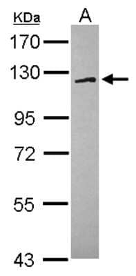 Western Blot: FAM120A Antibody [NBP2-16412] - Sample (30 ug of whole cell lysate) A: MCF-7 7. 5% SDS PAGE gel, diluted at 1:1000.