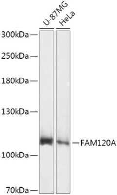 Western Blot: FAM120A Antibody [NBP3-04449] - Analysis of extracts of various cell lines, using FAM120A antibody at 1:1000 dilution. Secondary antibody: HRP Goat Anti-Rabbit IgG (H+L) at 1:10000 dilution. Lysates/proteins: 25ug per lane. Blocking buffer: 3% nonfat dry milk in TBST. Detection: ECL Basic Kit