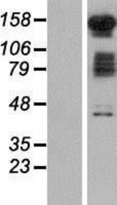 Western Blot: FAM120B Overexpression Lysate (Adult Normal) [NBP2-06027] Left-Empty vector transfected control cell lysate (HEK293 cell lysate); Right -Over-expression Lysate for FAM120B.