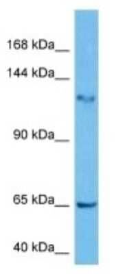 Western Blot: FAM120C Antibody [NBP3-10983] - Western blot analysis of FAM120C in Human A549 Whole Cell lysates. Antibody dilution at 2ug/ml