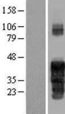 Western Blot: FAM122A Overexpression Lysate (Adult Normal) [NBP2-05657] Left-Empty vector transfected control cell lysate (HEK293 cell lysate); Right -Over-expression Lysate for FAM122A.