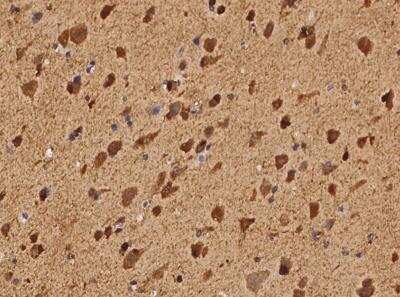 Immunohistochemistry-Paraffin: FAM123A Antibody [NBP3-05964] - Staining of human FAM123A in human brain with rabbit polyclonal antibody at 1:100 dilution.
