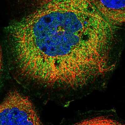 Immunocytochemistry/Immunofluorescence: FAM126A Antibody [NBP2-13980] - Immunofluorescent staining of human cell line A-431 shows localization to plasma membrane & cytosol.