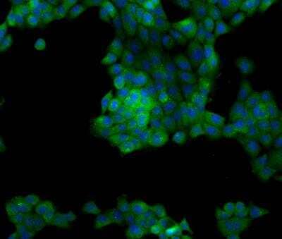 Immunocytochemistry/Immunofluorescence: FAM126A Antibody [NBP3-12634] - Staining of FAM126A in A431 cells. Cells were fixed with 4% PFA, permeabilzed with 0.1% Triton X-100 in PBS,blocked with 10% serum, and incubated with rabbit anti-Human FAM126A polyclonal antibody (dilution ratio 1:200) at 4? overnight. Then cells were stained with the Alexa Fluor®488-conjugated Goat Anti-rabbit IgG secondary antibody (green) and counterstained with DAPI (blue).Positive staining was localized to Cytoplasm.