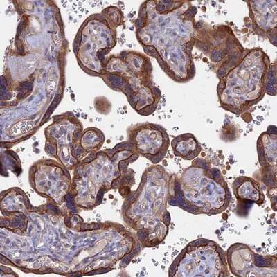 Immunohistochemistry-Paraffin: FAM126A Antibody [NBP2-13980] - Staining of human placenta shows strong cytoplasmic and membranous positivity in trophoblastic cells.