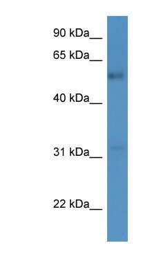 Western Blot: FAM126A Antibody [NBP1-79800] - Human Lung lysate, concentration 0.2-1 ug/ml.