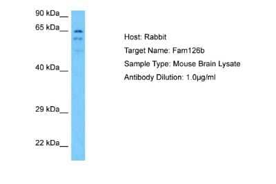 Western Blot: FAM126B Antibody [NBP2-87404] - Host: Rabbit. Target Name: FAM126B. Sample Tissue: Mouse Brain lysates. Antibody Dilution: 1ug/ml