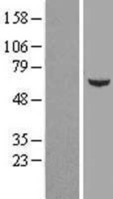 Western Blot: FAM126B Overexpression Lysate (Adult Normal) [NBL1-10464] Left-Empty vector transfected control cell lysate (HEK293 cell lysate); Right -Over-expression Lysate for FAM126B.