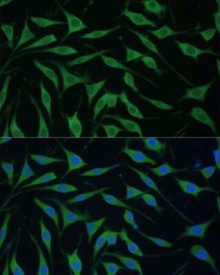 Immunocytochemistry/ Immunofluorescence FAM127B Antibody - Azide and BSA Free