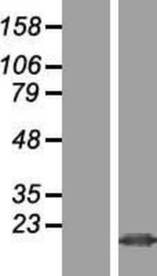 Western Blot: FAM128B Overexpression Lysate (Adult Normal) [NBL1-10466] Left-Empty vector transfected control cell lysate (HEK293 cell lysate); Right -Over-expression Lysate for FAM128B.