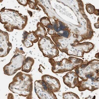 <b>Independent Antibodies Validation. </b>Immunohistochemistry-Paraffin: FAM129B Antibody [NBP1-88783] - Staining of human placenta shows strong cytoplasmic positivity in trophoblastic cells.