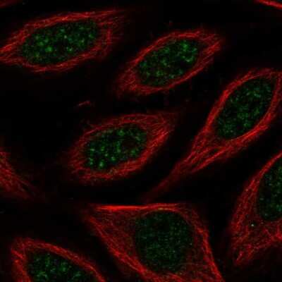 Immunocytochemistry/Immunofluorescence: FAM130A1 Antibody [NBP2-58064] - Staining of human cell line SiHa shows localization to nuclear speckles.