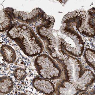 Immunohistochemistry-Paraffin: FAM130A1 Antibody [NBP1-89908] - Staining of human stomach shows strong cytoplasmic positivity in glandular cells.