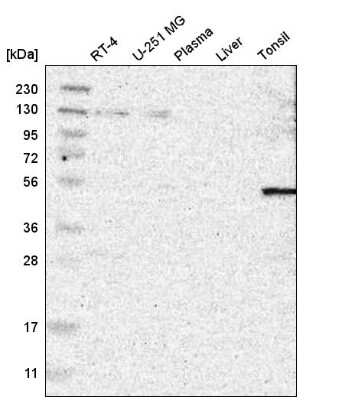 Western Blot: FAM130A1 Antibody [NBP2-58064] - Western blot analysis in human cell line RT-4, human cell line U-251 MG, human plasma, human liver tissue and human tonsil tissue.