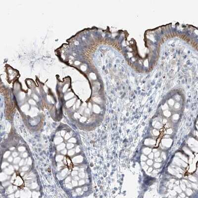 Immunohistochemistry-Paraffin: FAM131C Antibody [NBP2-13981] - Staining of human colon shows strong luminal membranous positivity in glandular cells.