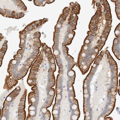 Immunohistochemistry-Paraffin: Adipolin/FAM132A Antibody [NBP1-90700] - Staining of human colon shows membranous and cytoplasmic positivity in glandular cells.