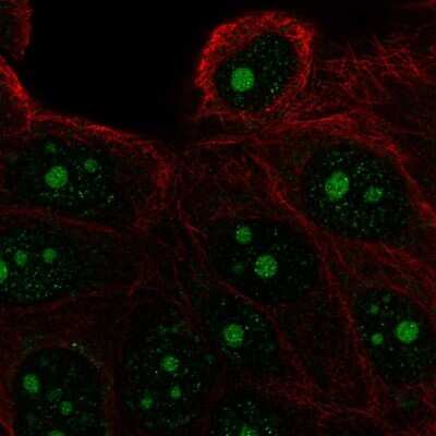 Immunocytochemistry/Immunofluorescence: FAM133A Antibody [NBP2-55696] - Staining of human cell line MCF7 shows localization to nucleoli.