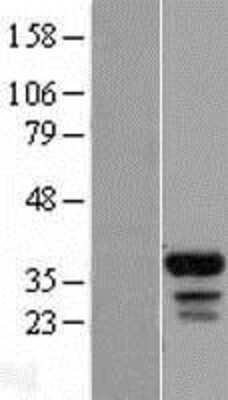 Western Blot FAM133B Overexpression Lysate