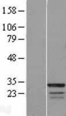 Western Blot FAM133B Overexpression Lysate