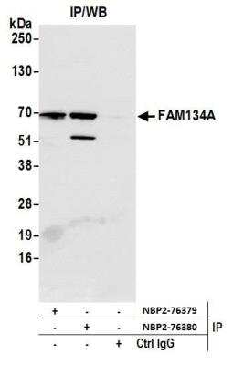 Immunoprecipitation: FAM134A Antibody [NBP2-76379] - Samples: Whole cell lysate (1.0 mg per IP reaction; 20% of IP loaded) from K-562 cells prepared using NETN lysis buffer. Antibodies: Affinity purified rabbit anti-FAM134A antibody NBP2-76379 used for IP at 15 ul per reaction. FAM134A was also immunoprecipitated by rabbit anti-FAM134A antibody NBP2-76380. For blotting immunoprecipitated FAM134A, NBP2-76380 was used at 1:200. Detection: Chemiluminescence with an exposure time of 1 second.