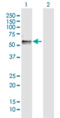 Western Blot: FAM134B Antibody [H00054463-D01P] - Analysis of FAM134B expression in transfected 293T cell line by FAM134B polyclonal antibody.Lane 1: FAM134B transfected lysate(39.27 KDa).Lane 2: Non-transfected lysate.