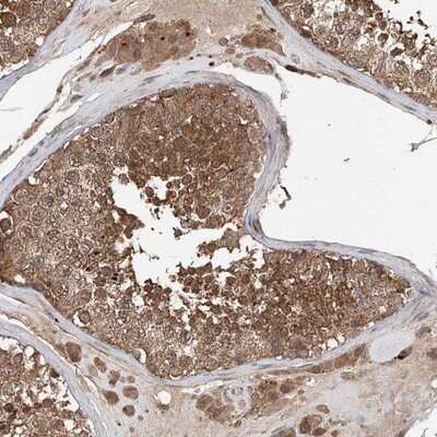 Immunohistochemistry-Paraffin: FAM135A Antibody [NBP1-93987] - Staining of human testis shows strong cytoplasmic and nuclear positivity in cells in seminiferus ducts.