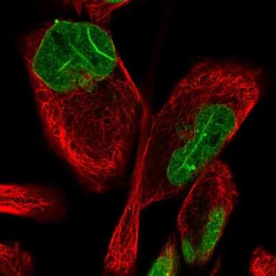 Immunocytochemistry/Immunofluorescence: FAM135B Antibody [NBP1-86717] - Staining of human cell line RH-30 shows localization to nucleoplasm & nuclear membrane. Antibody staining is shown in green.