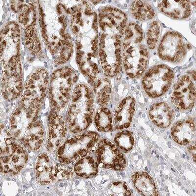 Immunohistochemistry: FAM135B Antibody [NBP1-86716] - Staining of human kidney shows strong cytoplasmic positivity in tubule cells.