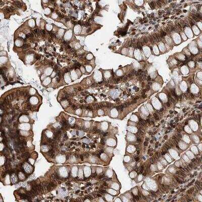 Immunohistochemistry-Paraffin: FAM135B Antibody [NBP1-86717] - Staining of human small intestine shows strong nuclear membrane positivity and slightly weaker cytoplasmic staining in glandular cells.