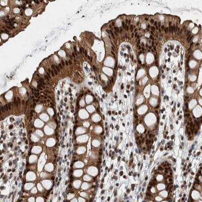 Immunohistochemistry: FAM135B Antibody [NBP1-86718] - Staining of human rectum shows strong nuclear and cytoplasmic positivity in glandular cells.