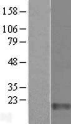Western Blot: FAM136A Overexpression Lysate (Adult Normal) [NBL1-10477] Left-Empty vector transfected control cell lysate (HEK293 cell lysate); Right -Over-expression Lysate for FAM136A.