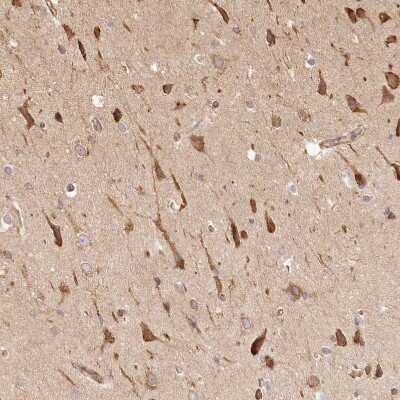 Immunohistochemistry-Paraffin FAM13A Antibody