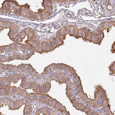 Immunohistochemistry-Paraffin FAM13A Antibody